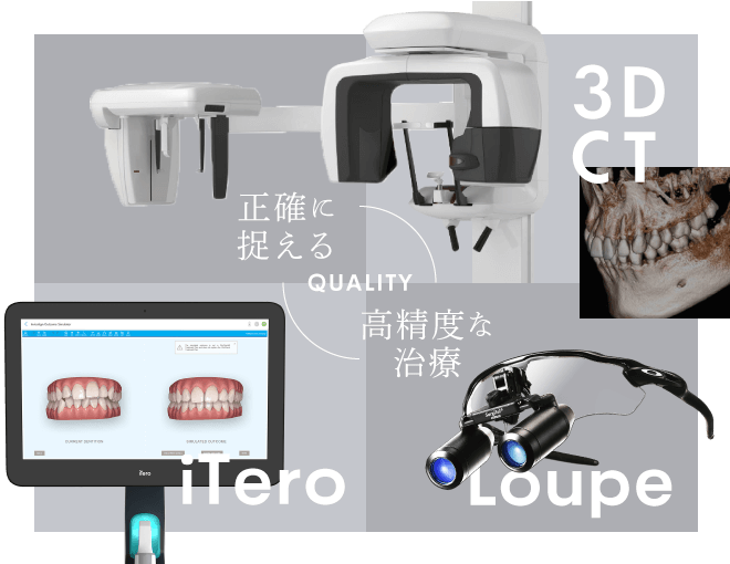 3DCT・iTero・Loupe＜正確に捉える／高精度な治療＞